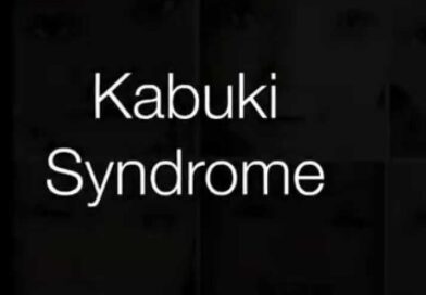 Ημέρα Ευαισθητοποίησης για το Σύνδρομο Καμπούκι